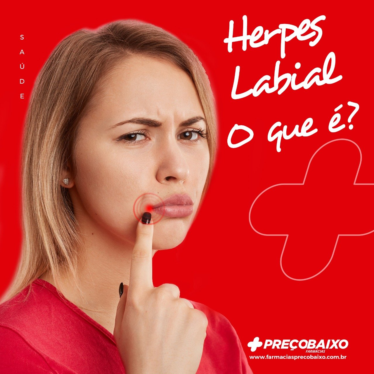Read more about the article Herpes labial: o que é, tratamento e cura
